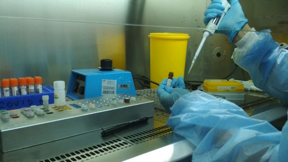 España ha realizado casi dos millones de PCR desde el inicio de la epidemia