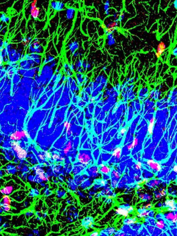 Descubierto un nuevo mecanismo para activar las células madre del cerebro adulto