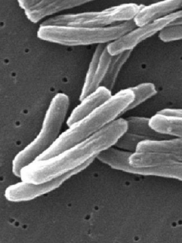 Un estudio del CSIC encuentra nuevos genes relacionados con la resistencia al principal tratamiento de la tuberculosis