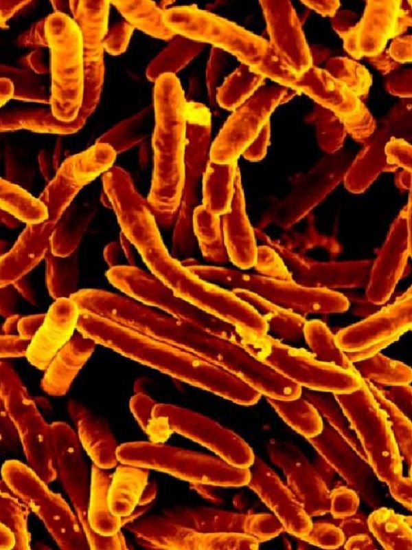 Descifrando la transmisión asintomática de la tuberculosis