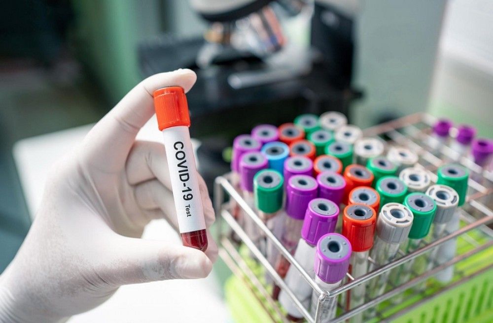 El Gobierno distribuye un millón más de test rápidos de detección de anticuerpos para diagnosticar el COVID-1