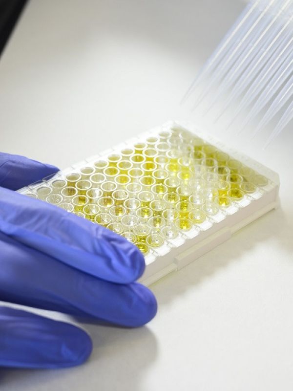 El CSIC firma una licencia para facilitar que sus test de anticuerpos de covid-19 lleguen a los países más necesitados