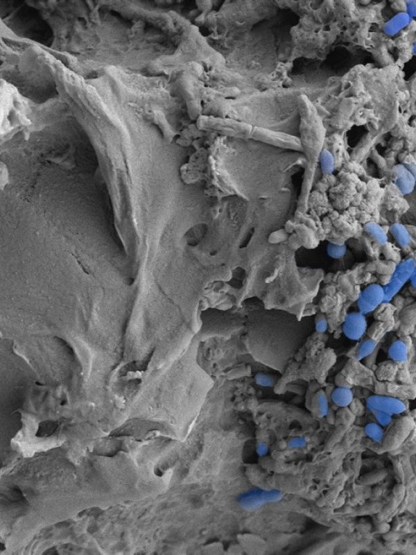 Un estudio demuestra que la ingesta de microplásticos altera la microbiota intestinal