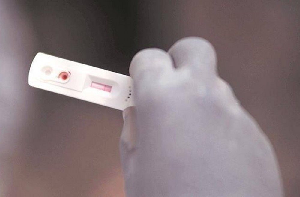 La Comisión de Salud Pública aprueba incluir los test antigénicos como herramienta rápida de diagnóstico y cribado de la COVID-19