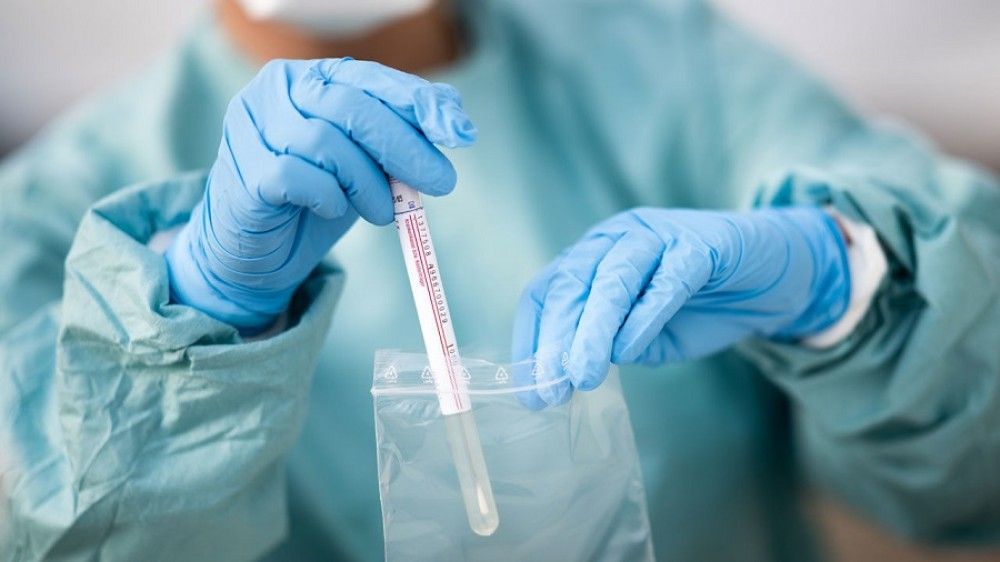 Sanidad asegura que los tests defectuosos comprados a China contaban con homologación europea