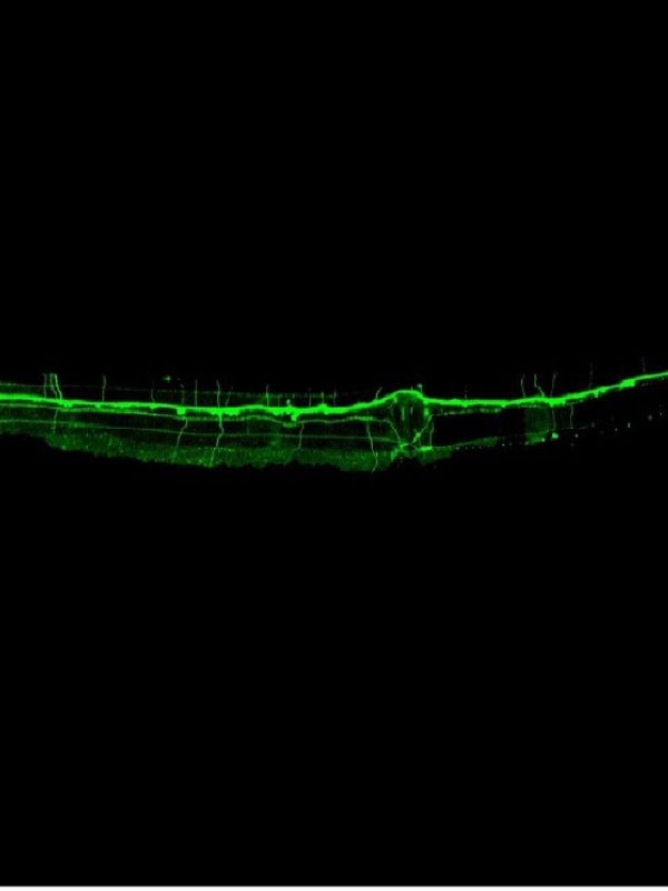 Un estudio del CSIC observa un mecanismo inédito en la formación de las neuronas sensoriales