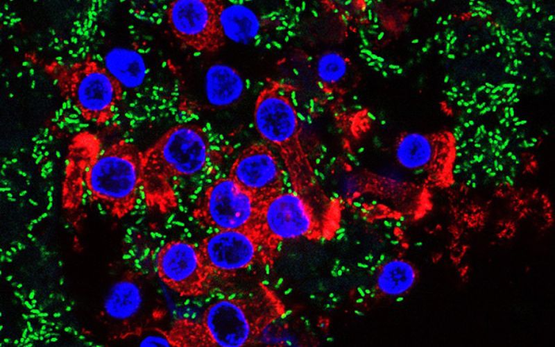 Identifican una nueva estrategia para combatir la resistencia bacteriana a los antibióticos