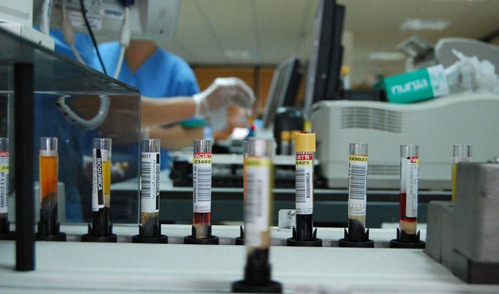 El Ministerio de Sanidad publica una guía de cribado de la infección por Hepatitis C