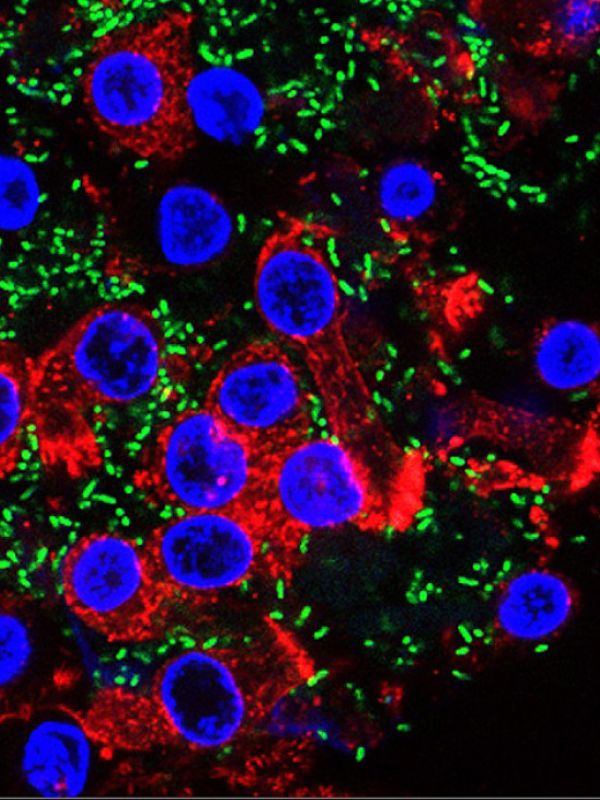 Identifican una nueva estrategia para combatir la resistencia bacteriana a los antibióticos