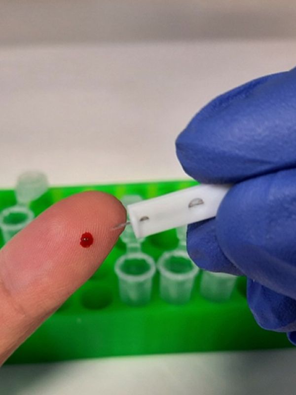 Un nuevo test de anticuerpos para COVID-19 logra mayor sensibilidad al basarse en la proteína spike’ completa