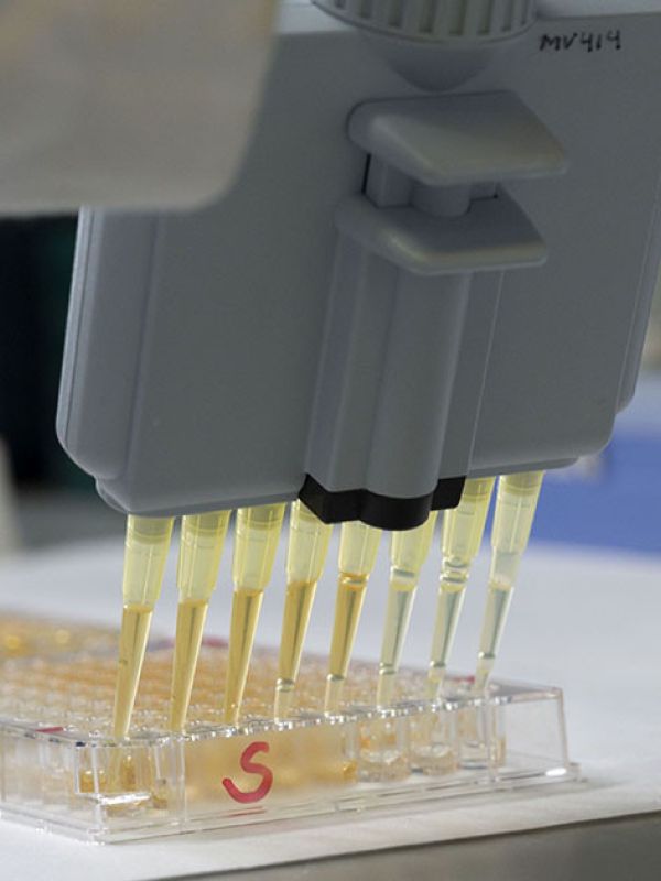 Los test serológicos para la covid-19 del CSIC se producirán en Suráfrica para llegar a los países africanos