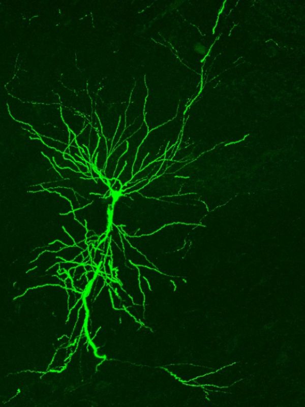 Desarrollan una sonda que emplea la luz para el diagnóstico de patologías cerebrales