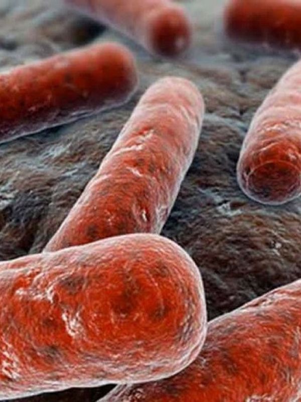 Un estudio del CSIC revela que las infecciones múltiples son comunes en tuberculosis multirresistente