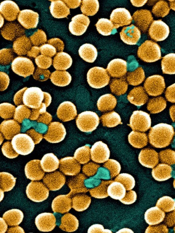 Desvelado el mecanismo que gobierna la división celular en una de las superbacterias más letales