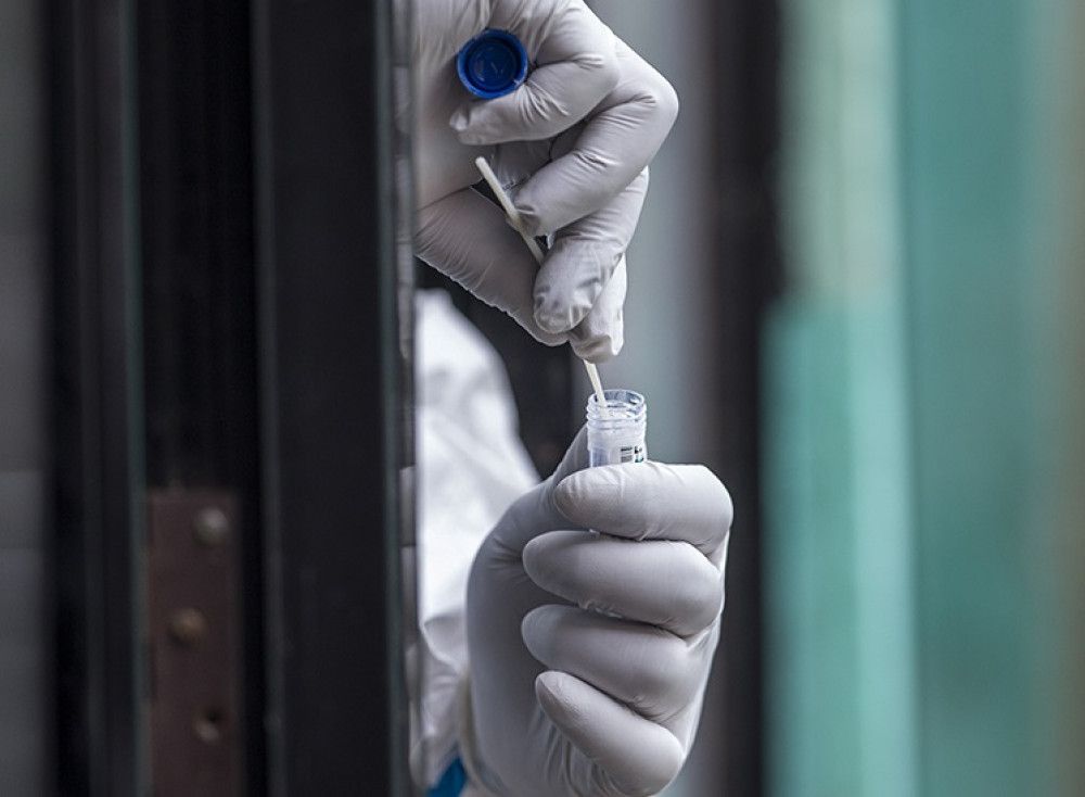 España ha realizado más de 37 millones de pruebas diagnósticas desde el inicio de la epidemia