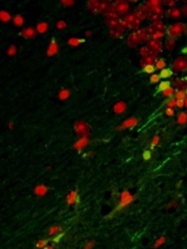 Describen un patrón evolutivo común en el desarrollo de diferentes tipos de neuronas