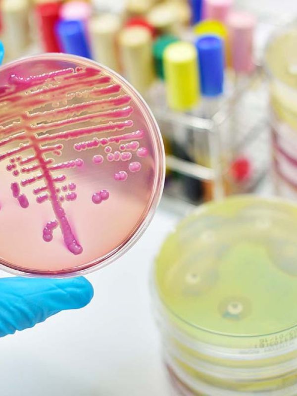 Un estudio aborda la función de las bacterias intestinales para desarrollar nuevos probióticos