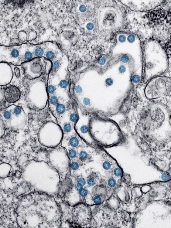 Investigadores del CSIC obtienen un nanomaterial que elimina el coronavirus y es aplicable en mascarillas y tejidos
