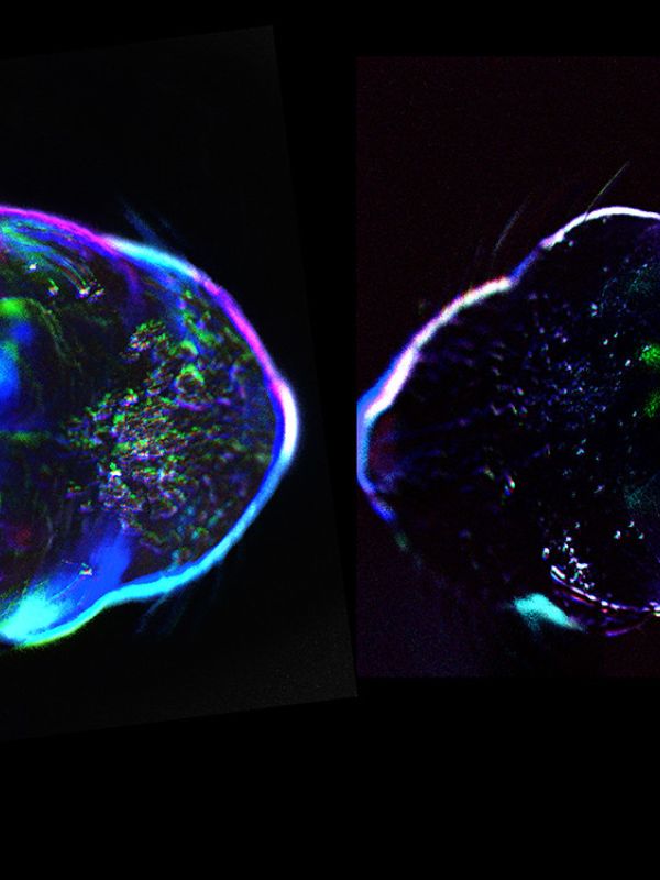 Los sentidos del tacto y la vista se activan simultáneamente en el cerebro antes del nacimiento