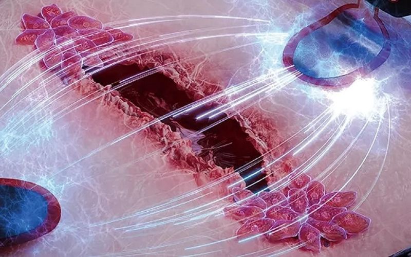 Encuentran una forma de curar heridas 3 veces más rápido usando electricidad