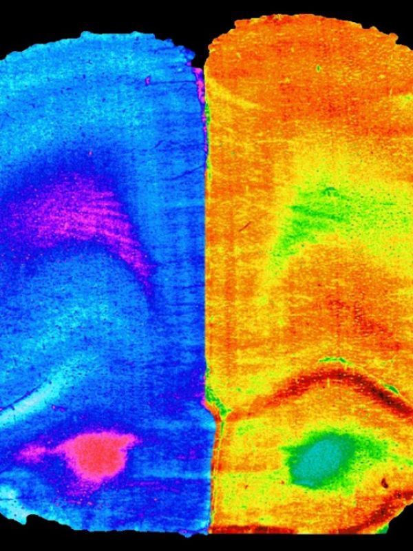 El deporte y el consumo de un nuevo probiótico mejoran la cognición de los enfermos hepáticos