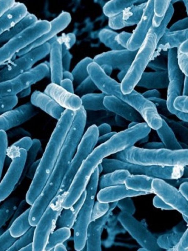 Investigadores del CSIC describen la evolución de la bacteria de la tuberculosis