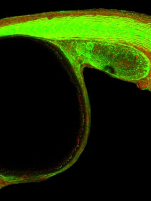 El CSIC demuestra que el plegamiento tridimensional del genoma es esencial para el desarrollo embrionario