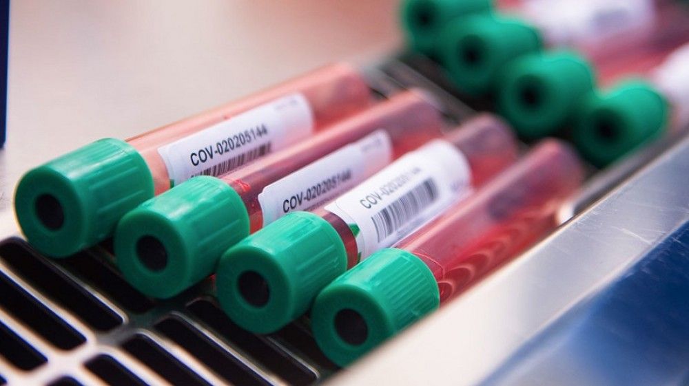 La OMS pide a Oxford AstraZeneca datos y no "notas de prensa" para poder determinar la eficacia de su vacuna contra el COVID-19