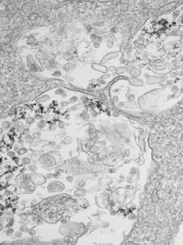 Las nanopartículas de óxido de hierro atajan la replicación del SARS-CoV-2