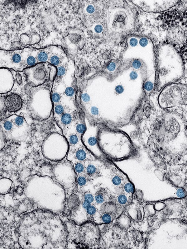 El CNB-CSIC investiga en antivirales, vacunas, test serológicos y modelos predictivos frente a la covid-19