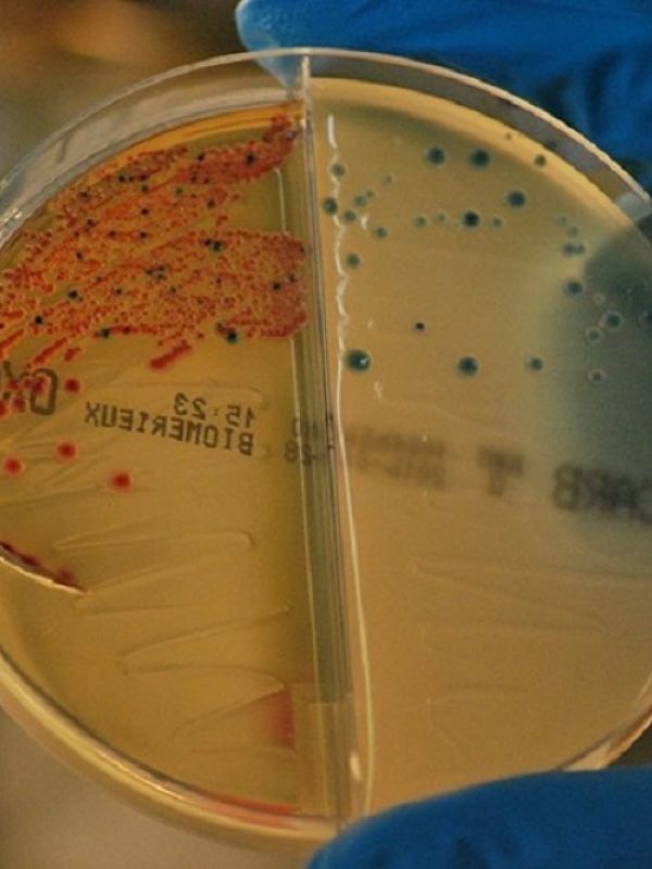 Identificada una nueva estrategia para frenar las resistencias a los antibióticos