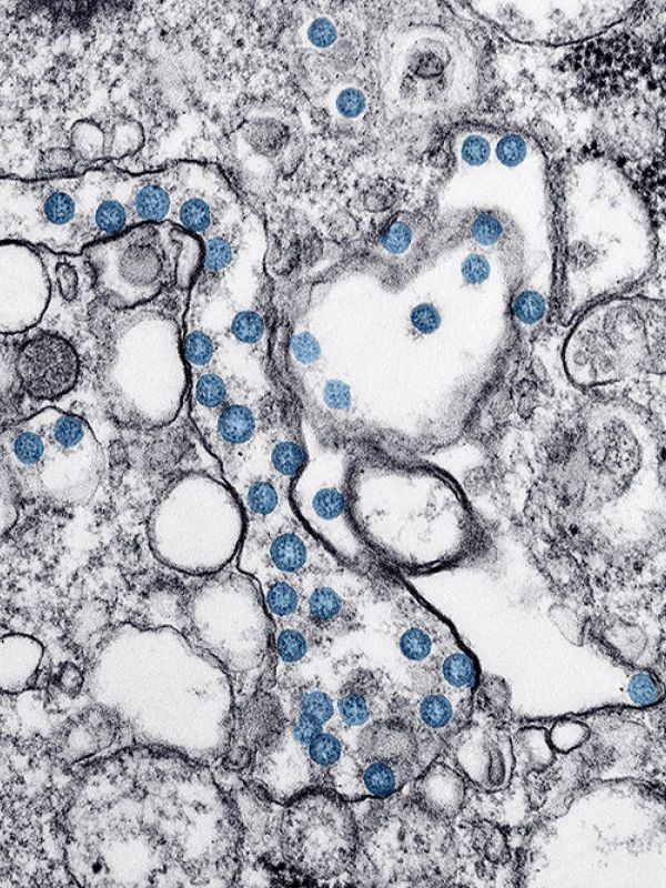 Un estudio del CSIC muestra la implicación del envejecimiento celular en los efectos de la covid-19