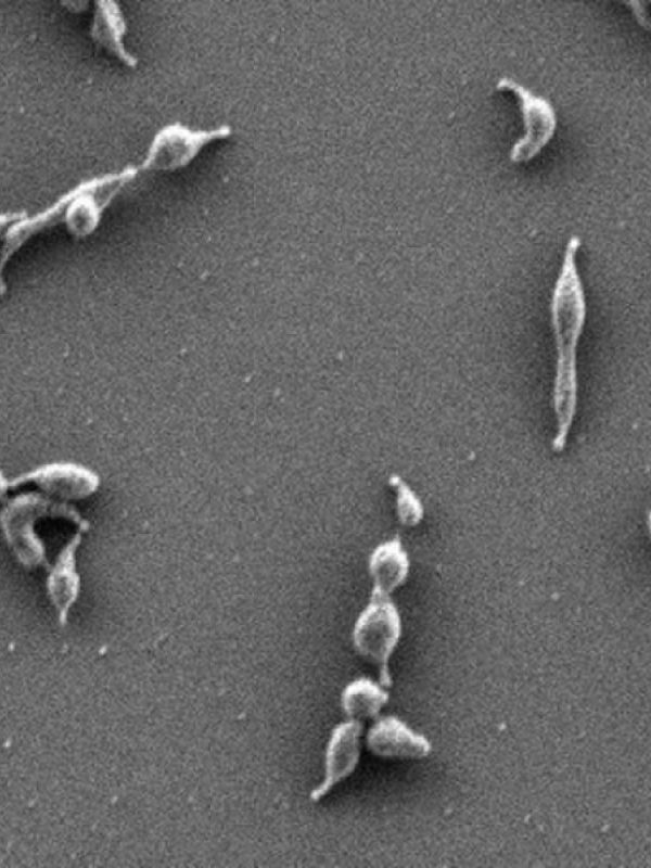 Descrito un mecanismo molecular por el que las bacterias se adhieren a las células para infectarlas